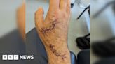 Dog bite victim left 'anxious and fearful'