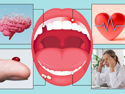 10 things your TEETH can reveal about your health from silent killer to dementia