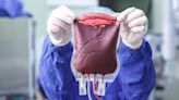 Liberal Blood Transfusion After Traumatic Brain Injury May Hold Benefit