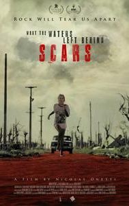 Scars