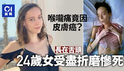 24歲女喉嚨痛竟是皮膚癌 原非致命癌症卻因長在舌頭受盡折磨離世