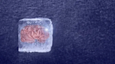 復旦大學宣布重大突破 成功復活「冷凍18個月人腦」