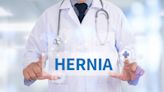 ¿Cuáles son los síntomas que alertan de que puedes tener una hernia inguinal?