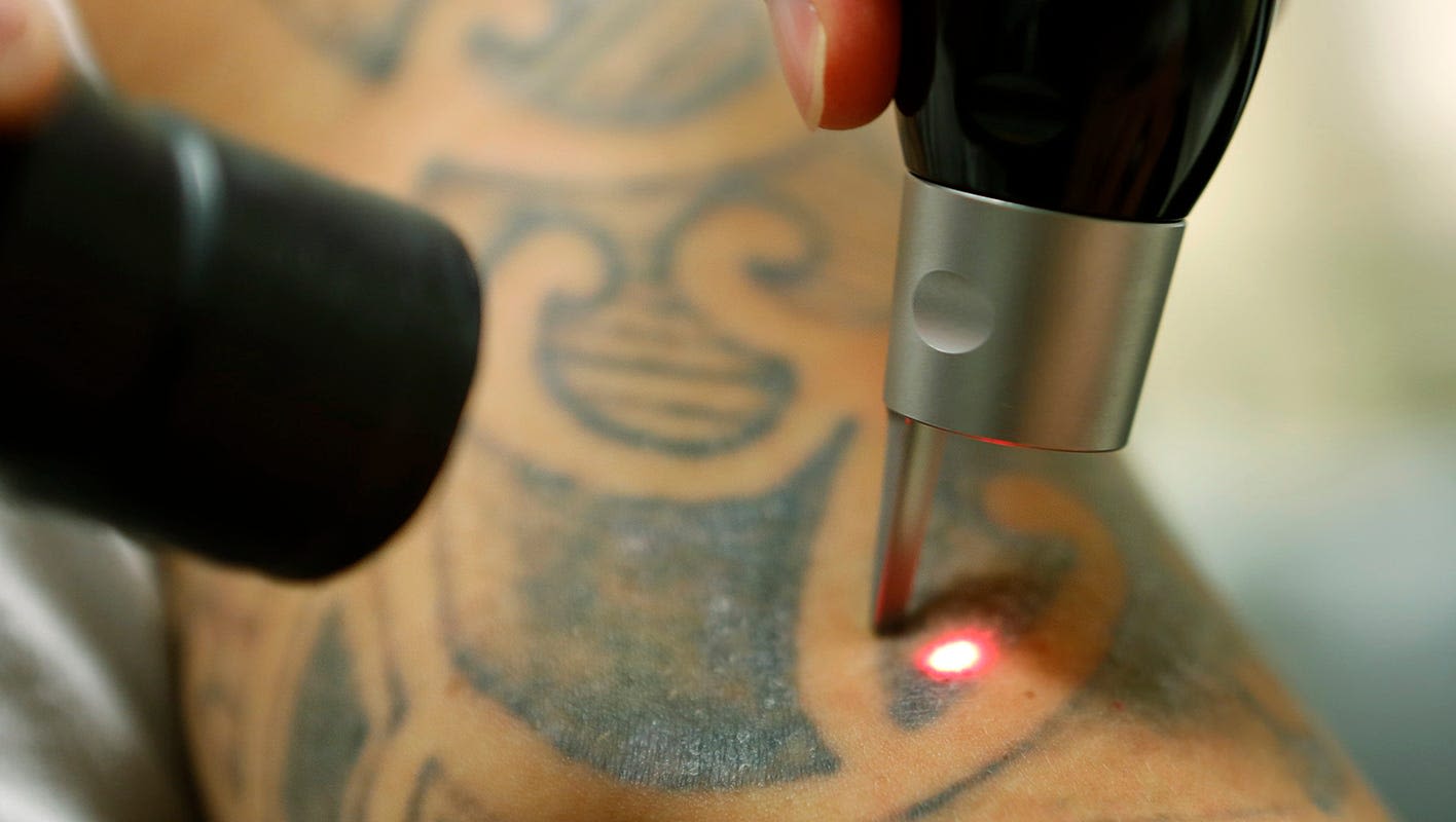 'No regerts?' Florida ranks in top 10 for states most likely to remove tattoos