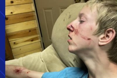 Arizona boy recovers from rare bear attack - UPI.com