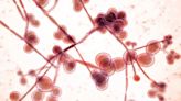 La lista negra de los hongos patógenos: ¿por qué son tan peligrosos?
