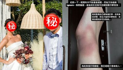 顧家男歌手惹家暴疑雲嬌妻突發傷勢照 怒斥忍無可忍嬲到打嘢發洩