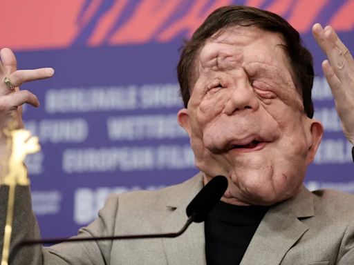 La inspiradora historia de Adam Pearson: el actor con neurofibromatosis que triunfa en Hollywood