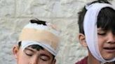 Injured Palestinian boys at Al-Aqsa Martyrs Hospital react as their family waits to identify bodies of relatives killed in Israeli bombardment