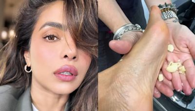 Priyanka Chopra’s Surprising Foot Care Hack: Garlic For Relief?