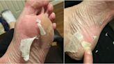 This $25 Foot Peel Makes Your Feet Crazy Soft
