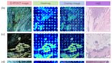 AI algorithms and optical imaging technology: A promising approach to intraoperative cancer diagnosis