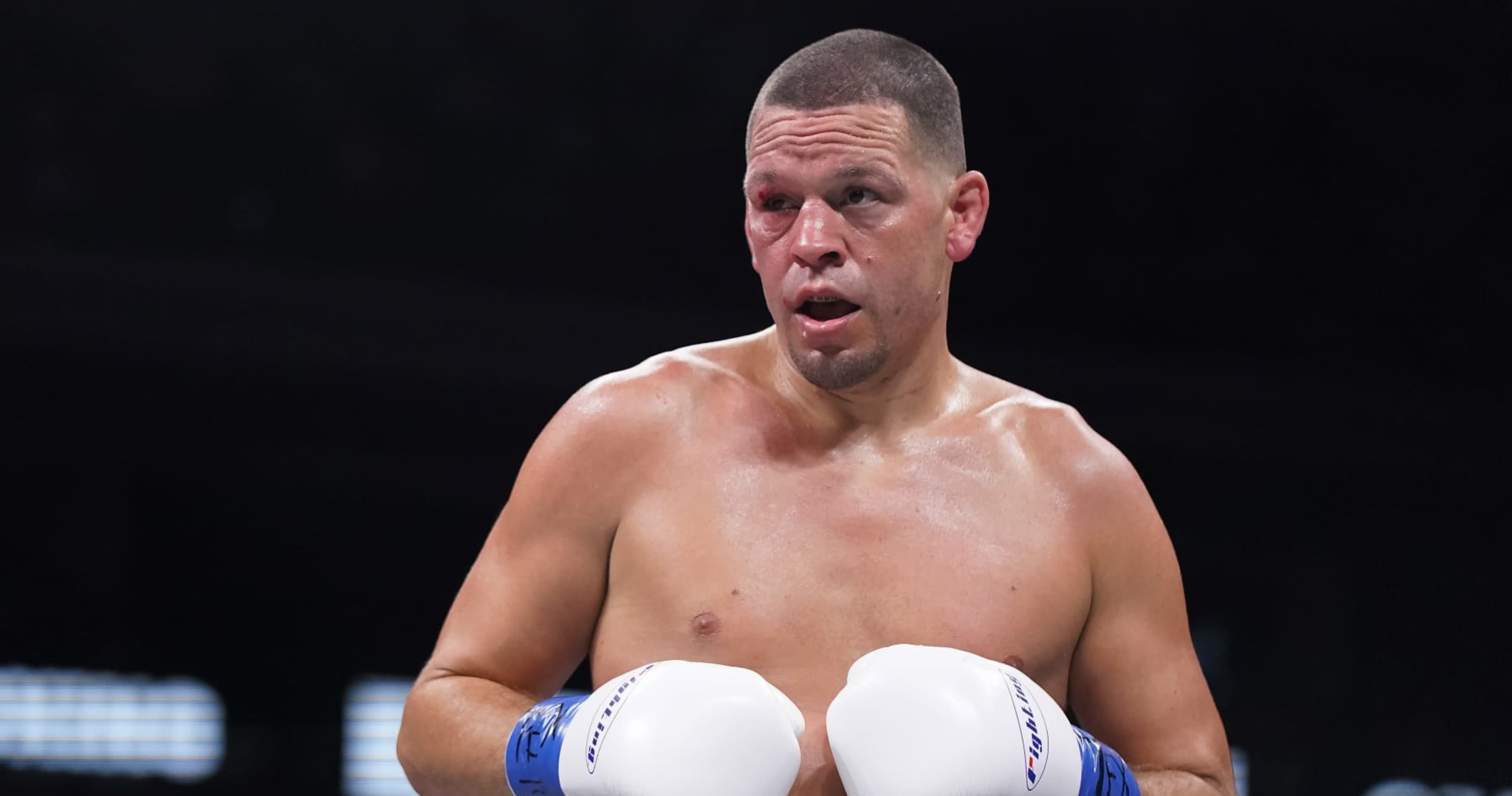 Former UFC Fighter Nate Diaz Sued by Man Seeking Damages After 2023 Street Fight