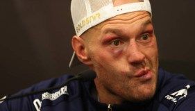 Tyson Fury 34-1-1 career boxing record IN FULL