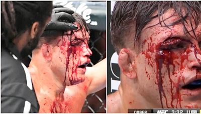 Drew Dober suffers one of the most gruesome cuts in UFC history - it was so gory it's gone viral