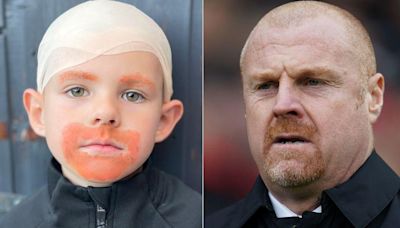 Boy, 5, comes to school fancy dress day as Sean Dyche