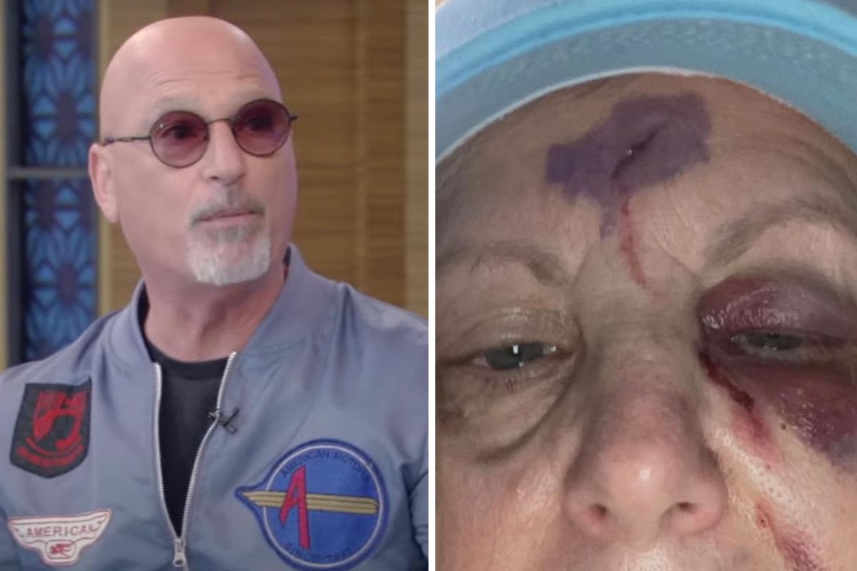 Howie Mandel tells 'Live' he "freaked" after seeing his wife’s "skull" following a brutal drunken fall