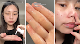 TikTok Is Hooked on This Cleansing Oil That Removes Blackheads on The Spot—& It’s $14 For 1 More Day