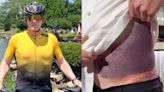 Gordon Ramsay Says He's Lucky To Be Alive After Terrifying Bike Accident