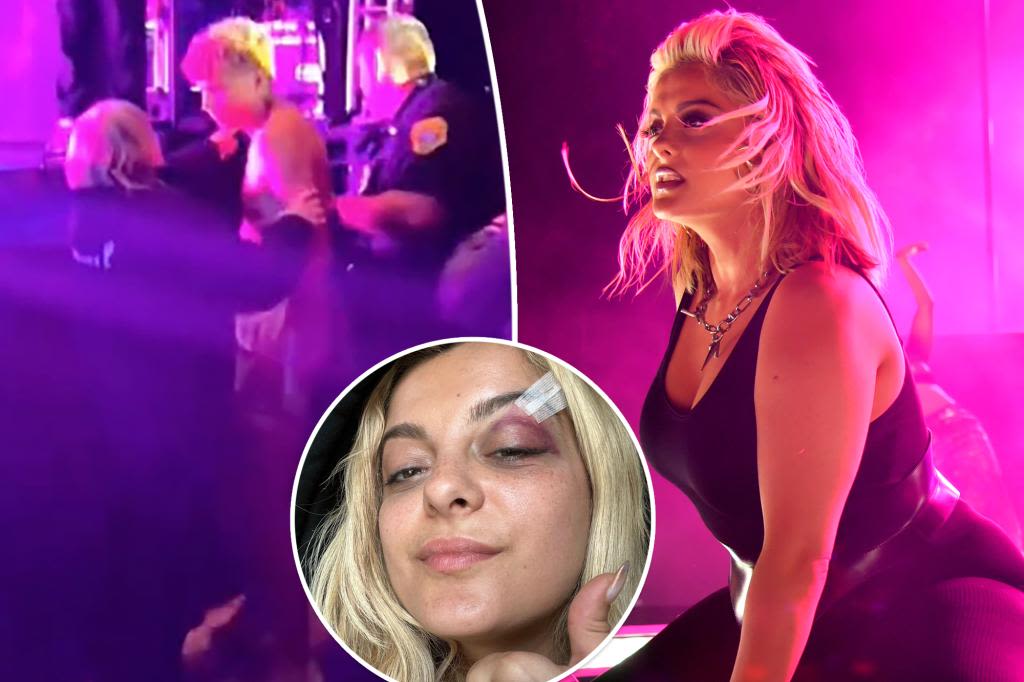 Bebe Rexha boots fan for hurling object at her 1 year after phone-throwing incident left her with black eye