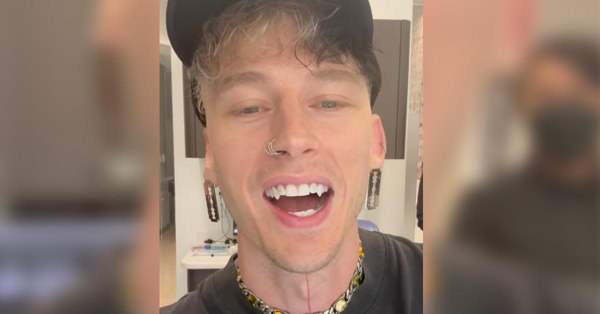 'Those Fangs Are Just Temporary, Right?': Machine Gun Kelly Divides Fans as He Shows Off New Teeth in Bold Look
