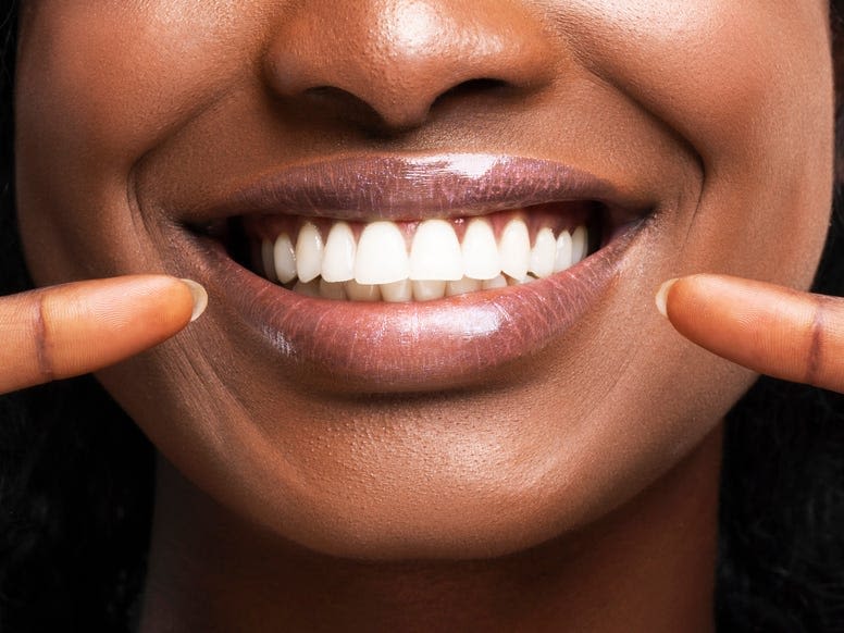 TikTokers are sharing horror stories of getting dental work by unlicensed 'veneer techs'