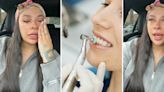 'It ruined my life': Woman issues dire warning about what can happen when you get veneers