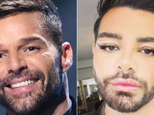 Argentino se realizó 30 cirugías para ser clon de Ricky Martin: “todos me amarían”