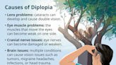 Diplopia (Double Vision) and Treatment Effectiveness