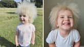 Girl nicknamed ‘Fluffy’ is one of only 100 people with ‘uncombable hair syndrome’