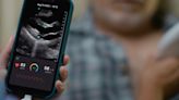 Exo brings AI heart, lung apps to its hand-held ultrasound probe