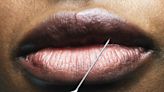 The Future of Lip Augmentation