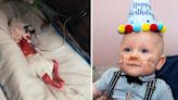 Baby born weighing just 1lb beats the odds to celebrate first birthday