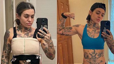 Morgan Wade Shares Update on Double Mastectomy Recovery: 'I Have 0 Regrets'
