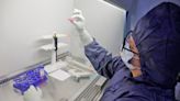 Ciencia argentina: el revolucionario laboratorio de piel que busca mejorar la calidad de vida a pacientes con úlceras crónicas