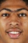 Anthony Davis