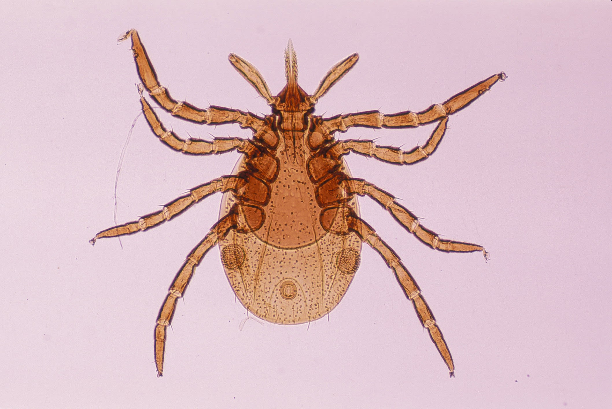 5 Signs of Lyme Disease You Really Shouldn’t Ignore