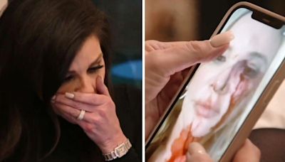 'RHOC': Shannon Beador shocks Heather Dubrow With harrowing photo of her bloodied face post-DUI