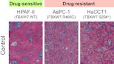 Scientists uncover key resistance mechanism to Wnt inhibitors in pancreatic and colorectal cancers