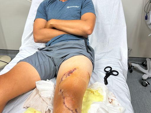 Florida man who survived Bahamas shark attack shares how he kept his cool: 'I'll be alright'