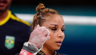 Brazilian Gymnast Flavia Saraiva Competes With Black Eye After Fall