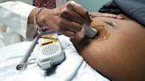 US maternal mortality rate the highest among high-income countries