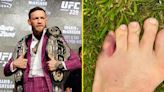 8Conor McGregor makes bold career prediction as UFC stars mock his broken toe