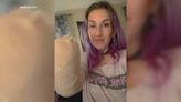 ‘It’s just a hand’: South Carolina woman’s hand amputated due to third-degree burns from hair dryer