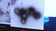 U.S. declares monkeypox a public health emergency