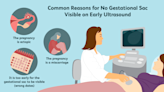 Does No Gestational Sac on the Ultrasound Mean I'm Not Pregnant?