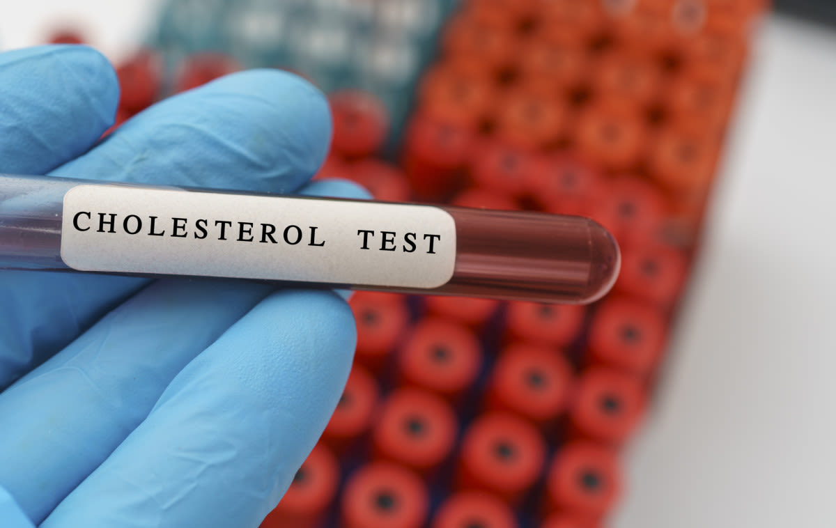 ‘I’m a Cardiologist—Here’s What I Want Everyone To Know about Borderline Cholesterol Readings'