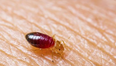 Don't let bed bugs wreck your summer vacation. Here's how to avoid these bloodsuckers