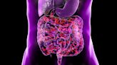 Microbiota Therapeutics Could Become Strong Ally in IBD Tx