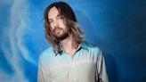 Tame Impala’s Kevin Parker Has Undergone Surgery for a Fractured Hip